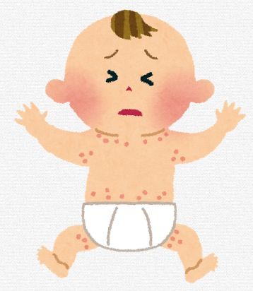 赤ちゃんの湿疹のイラスト
